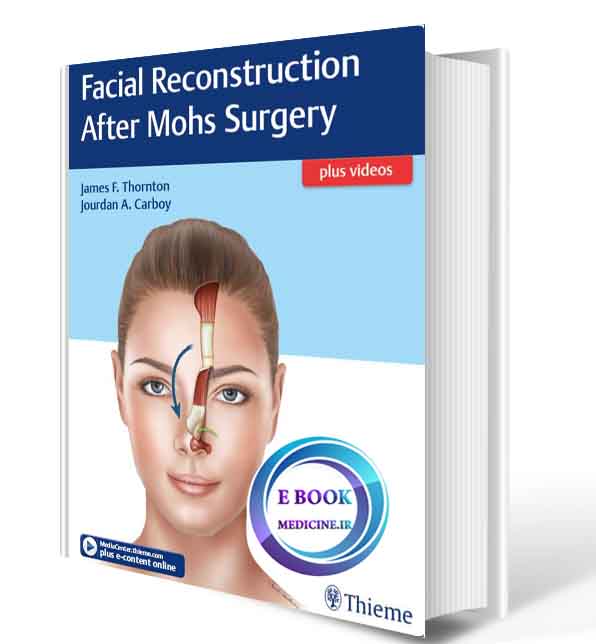 دانلود کتاب Facial Reconstruction After Mohs Surgery 2018(ORIGINAL PDF) 